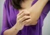 एलर्जी की समस्या से हो रहे है बार बार परेशान तो करे ये सरल उपाय Skin Allergy, Infection Ke Upay