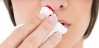 नाक से खून निकलने पर तुरंत करे ये उपाय Home Remedies Nose Bleeding